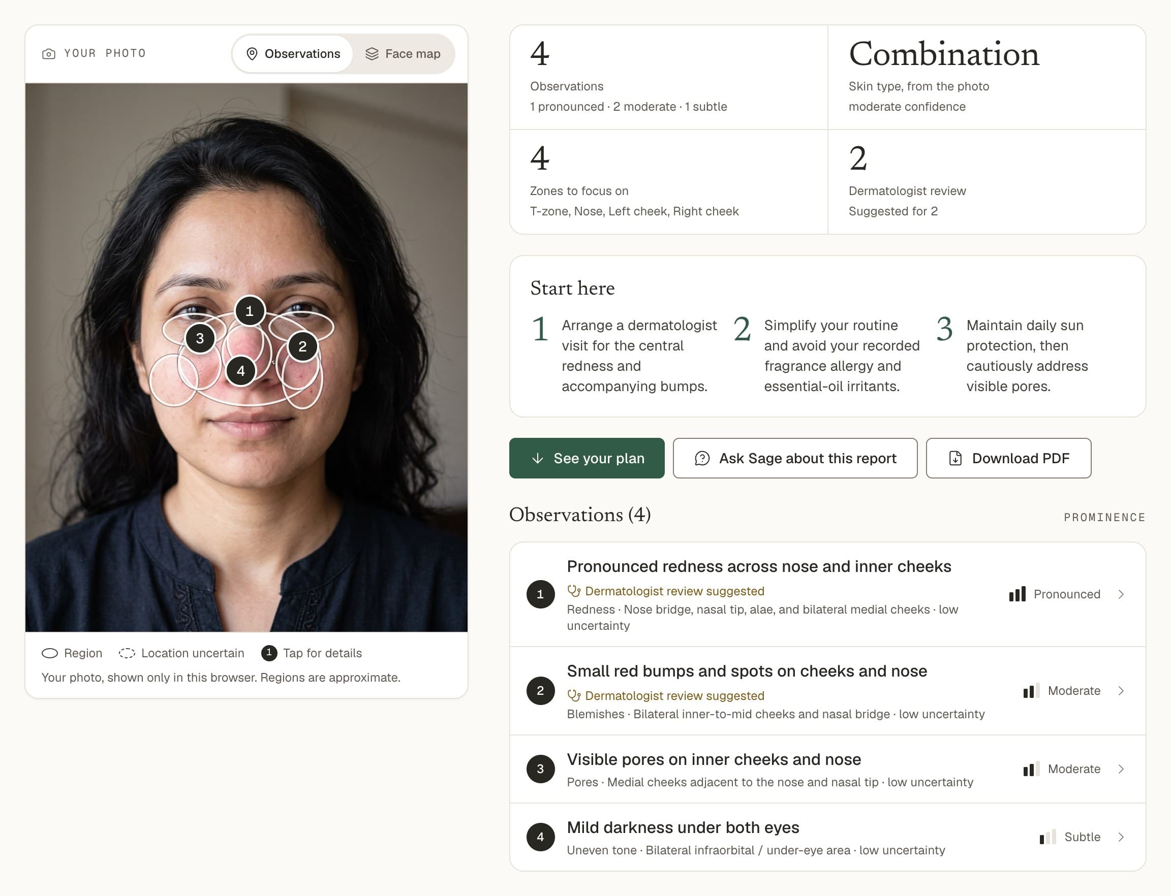 A real report on an AI-generated woman's face: four numbered regions marked on her nose, cheeks and under her eyes; at a glance, four observations and combination skin; where to start; and the observations by prominence, from pronounced redness across the nose and inner cheeks to mild darkness under the eyes